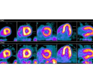 Advanced Molecular Imaging